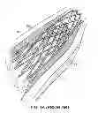 Fig. 02 - Stent for restenosis prevention