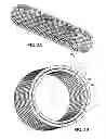Fig. 04 - Stent for restenosis prevention