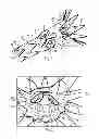 Fig. 02 - Prosthesis having pivoting fenestration