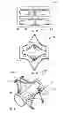 Fig. 05 - Hinge for medical device