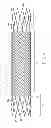 Fig. 02 - Multilayer stent