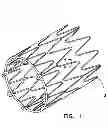 Fig. 02 - Bioabsorbable Medical Devices and Methods of Use Thereof
