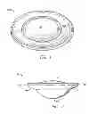 Fig. 02 - Accommodating intraocular lens