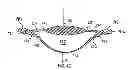 Fig. 05 - Accommodating intraocular lens
