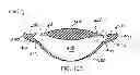 Fig. 11 - Accommodating intraocular lens