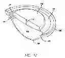 Fig. 13 - Accommodating intraocular lens