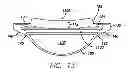 Fig. 14 - Accommodating intraocular lens