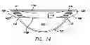 Fig. 15 - Accommodating intraocular lens