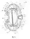 Fig. 03 - Curvature changing accommodative intraocular lens