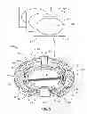 Fig. 06 - Curvature changing accommodative intraocular lens