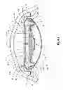Fig. 08 - Curvature changing accommodative intraocular lens
