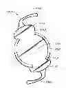 Fig. 01 - CURVATURE CHANGING ACCOMMODATIVE INTRAOCULAR LENS