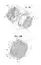 Fig. 03 - ACCOMMODATIVE INTRAOCULAR LENS