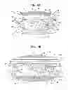 Fig. 04 - ACCOMMODATIVE INTRAOCULAR LENS