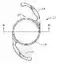 Fig. 01 - Edge design for reducing unwanted photic effects in intraocular lenses