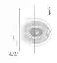 Fig. 06 - Accommodating intraocular lens providing progressive power change