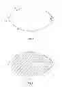 Fig. 02 - Retinal repair device and method