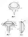 Fig. 03 - Device and method for making a variable surface breast implant