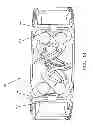 Fig. 15 - Device for securing an implant to tissue