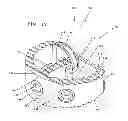 Fig. 18 - Device for securing an implant to tissue