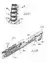 Fig. 33 - Device for securing an implant to tissue