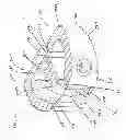 Fig. 58 - Device for securing an implant to tissue