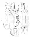 Fig. 64 - Device for securing an implant to tissue