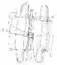 Fig. 66 - Device for securing an implant to tissue