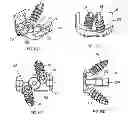 Fig. 11 - Low profile plate