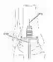 Fig. 01 - Cannulated modular tibial stem component pieces for use in total ankle arthroplasty and systems for installing and removing same