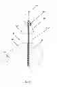 Fig. 07 - Cannulated modular tibial stem component pieces for use in total ankle arthroplasty and systems for installing and removing same