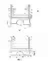 Fig. 02 - Ankle replacement devices and methods of making and using the same