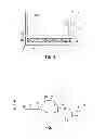 Fig. 03 - Ankle replacement devices and methods of making and using the same