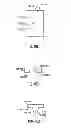 Fig. 07 - Ankle replacement devices and methods of making and using the same