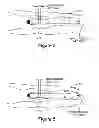 Fig. 04 - PERCUTANEOUS EXPANDING HAMMERTOE IMPLANT