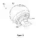 Fig. 03 - Modular junction seal of an orthopedic implant
