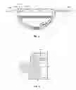 Fig. 04 - Implant components and methods