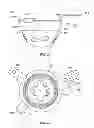 Fig. 16 - Implant components and methods