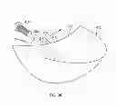 Fig. 19 - Implant components and methods