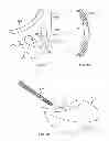 Fig. 20 - Implant components and methods