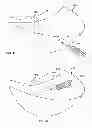 Fig. 22 - Implant components and methods