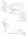 Fig. 28 - Implant components and methods