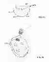 Fig. 34 - Implant components and methods