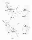 Fig. 41 - Implant components and methods