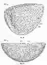 Fig. 43 - Implant components and methods