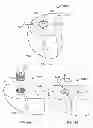 Fig. 46 - Implant components and methods