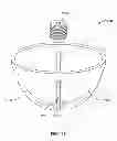 Fig. 52 - Implant components and methods