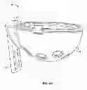 Fig. 58 - Implant components and methods