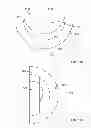 Fig. 60 - Implant components and methods