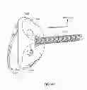 Fig. 63 - Implant components and methods